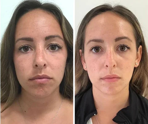 JORONDY® Power Redo Anti-Aging Cream-Last Day Sale🔥Buy 1 Get 3 Free🔥