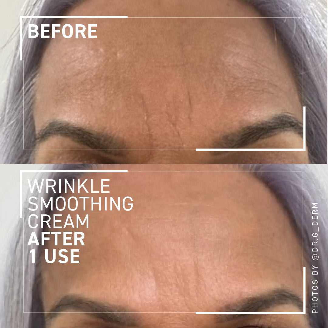 🔥Last Day Sale! 80% OFF!🔥||WRINKLE SMOOTHING CREAM