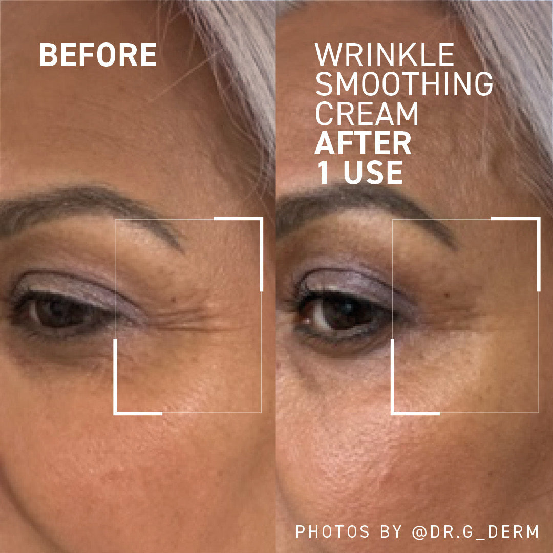 🔥Last Day Sale! 80% OFF!🔥||WRINKLE SMOOTHING CREAM