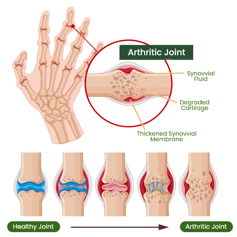 Adfire® Bee Venom Bone & Joint Revive Spray