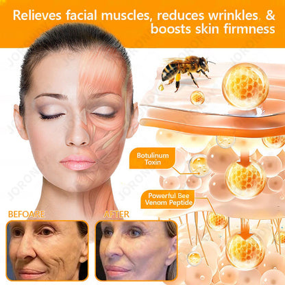 𝐎𝐅𝐅𝐈𝐂𝐈𝐀𝐋 𝐒𝐓𝐎𝐑𝐄!🐝 JORONDY® Bee Venom Senile Purpura Cream: The FDA-Registered Skincare Solution for Age-Related Skin Frailness.