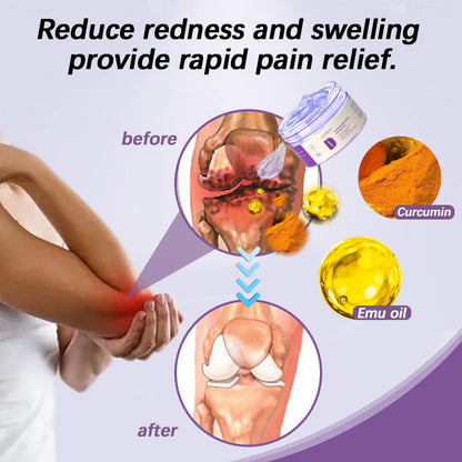 👨‍⚕️✅Official Store: Adfire® Turmeric & Emu Oil Arthritis Soothing Pain Relief Massage Gel (Copy)