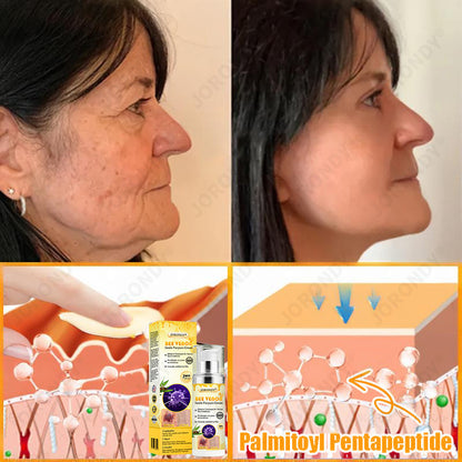 𝐎𝐅𝐅𝐈𝐂𝐈𝐀𝐋 𝐒𝐓𝐎𝐑𝐄!🐝 JORONDY® Bee Venom Senile Purpura Cream: The FDA-Registered Skincare Solution for Age-Related Skin Frailness.