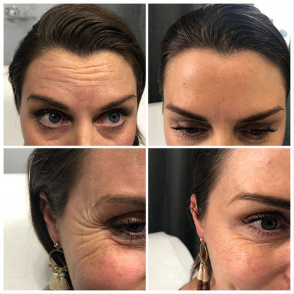 JORONDY® Power Redo Anti-Aging Cream-Last Day Sale🔥Buy 1 Get 3 Free🔥