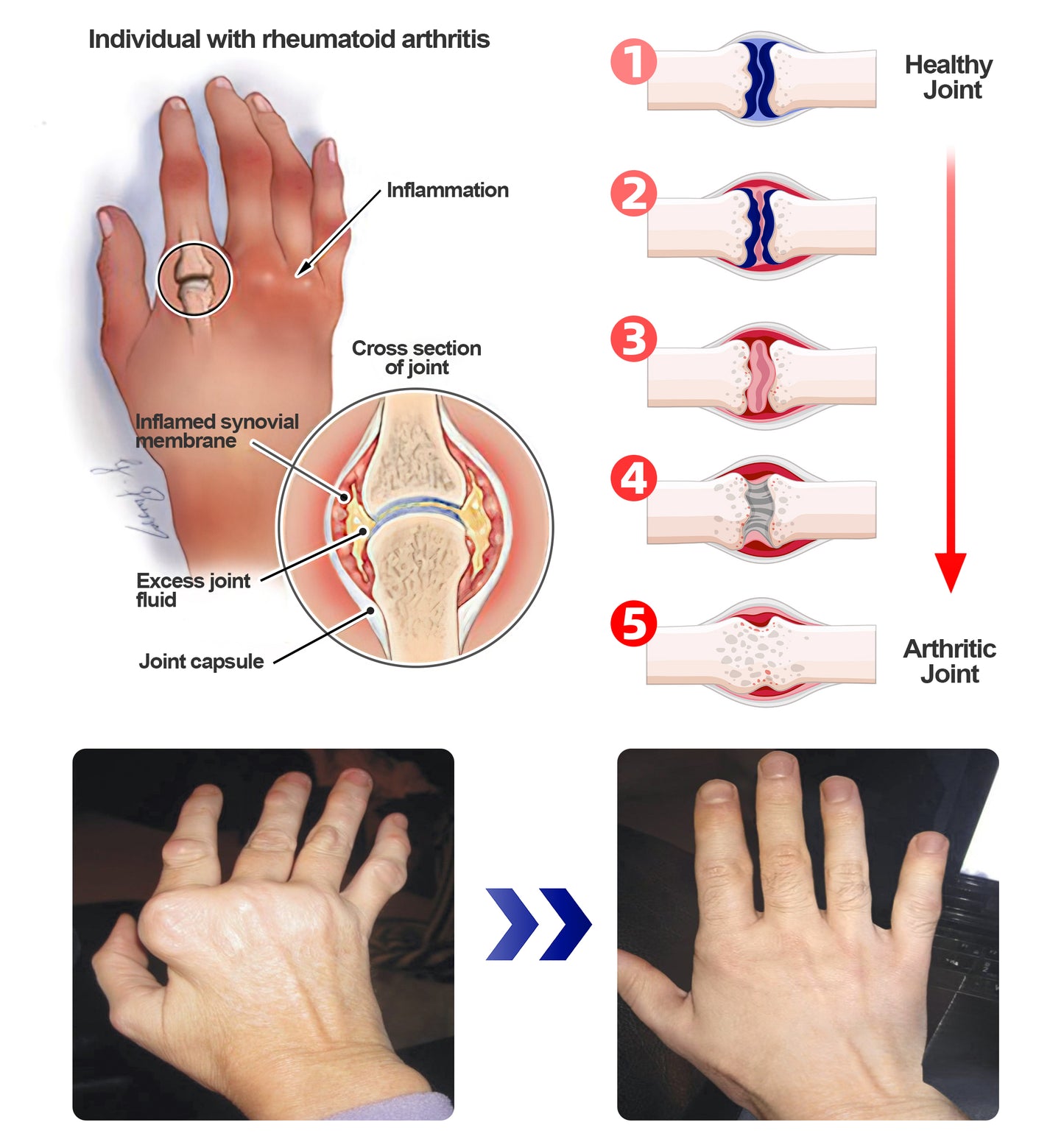 ADFIRE® Joint Genesis Protocol———The All-in-One Solution For Treating Pain All Over The Body