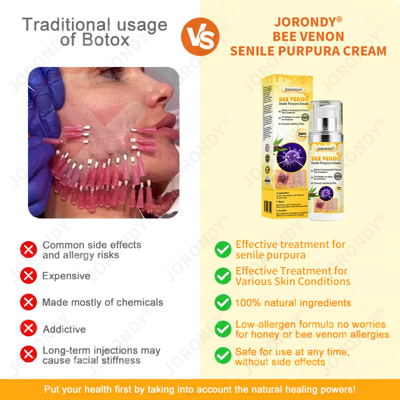 𝐎𝐅𝐅𝐈𝐂𝐈𝐀𝐋 𝐒𝐓𝐎𝐑𝐄!🐝 JORONDY® Bee Venom Senile Purpura Cream: The FDA-Registered Skincare Solution for Age-Related Skin Frailness.
