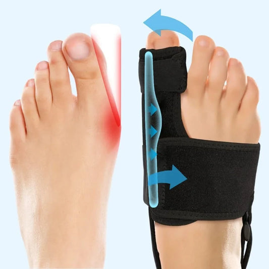 🔥Last Day Sale! 80% OFF!🔥||Struggling With Painful Bunions? Get Relief Without Surgery In Just 20 Minutes A Day!