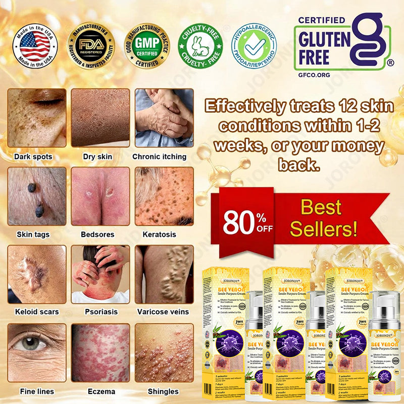 𝐎𝐅𝐅𝐈𝐂𝐈𝐀𝐋 𝐒𝐓𝐎𝐑𝐄!🐝 JORONDY® Bee Venom Senile Purpura Cream: The FDA-Registered Skincare Solution for Age-Related Skin Frailness.