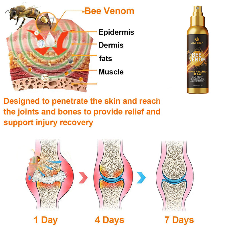 Jorondy® 🐝Bee Venom Pain-Relief Bone Healing Spray （Specially for older adults ）