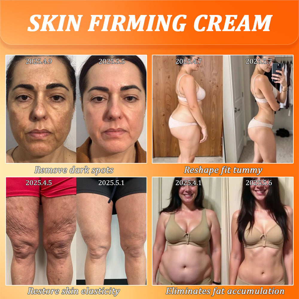 Jorondy® Skin Firming Cream🔥7 Days To See Results or 100% Refund| 90% OFF Last Day! 🔥