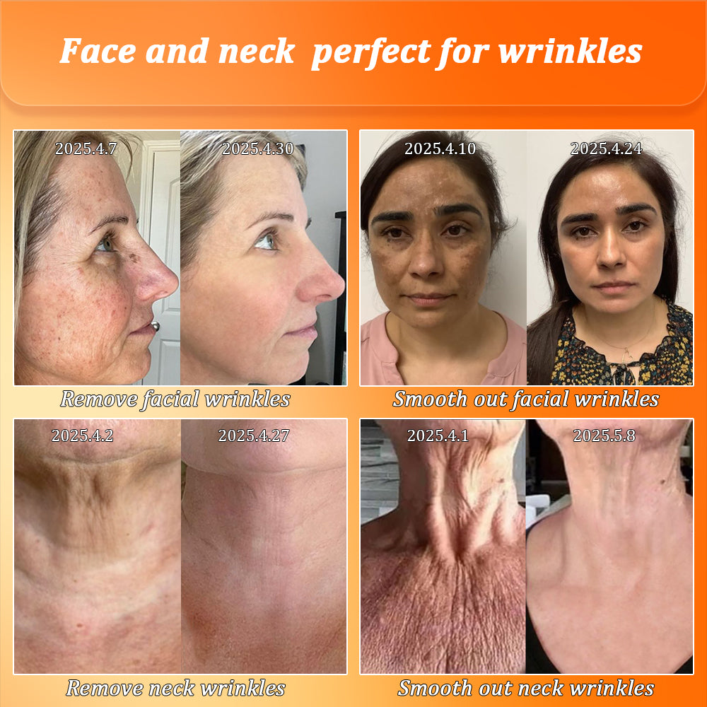 Jorondy® Skin Firming Cream🔥7 Days To See Results or 100% Refund| 90% OFF Last Day! 🔥
