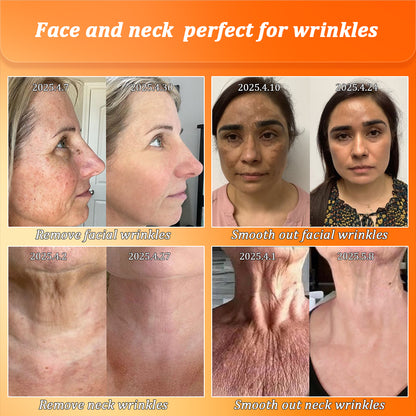Jorondy® Skin Firming Cream🔥7 Days To See Results or 100% Refund| 90% OFF Last Day! 🔥