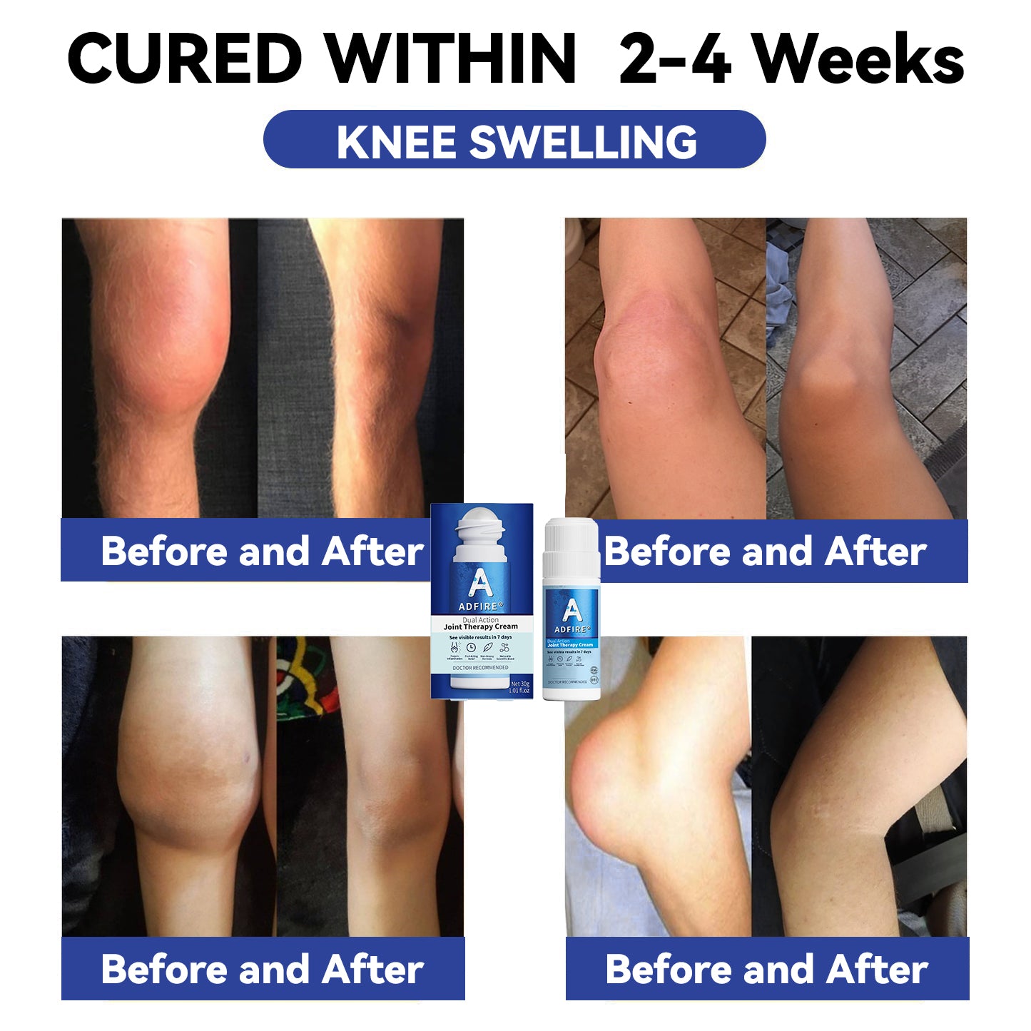 ADFIRE® Dual Action Joint Therapy Cream