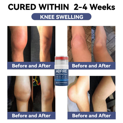 ADFIRE™ Dual Action Joint Therapy Cream