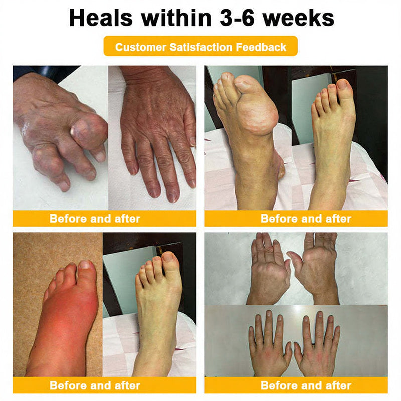 Jorondy® 🐝Bee Venom Pain-Relief Bone Healing Spray （Specially for older adults ）