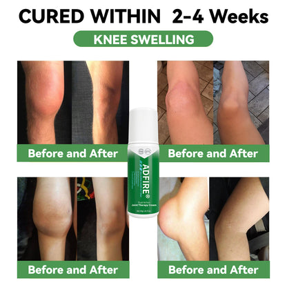 ADFIRE™ Dual Action Joint Therapy Cream