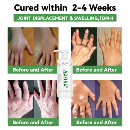 ADFIRE™ Dual Action Joint Therapy Cream