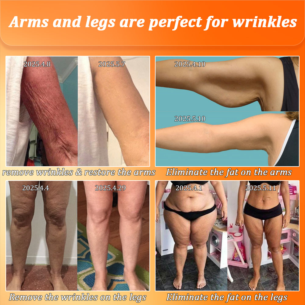 Jorondy® Skin Firming Cream🔥7 Days To See Results or 100% Refund| 90% OFF Last Day! 🔥
