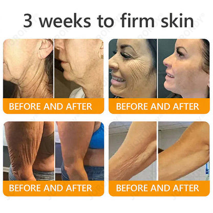 𝐎𝐅𝐅𝐈𝐂𝐈𝐀𝐋 𝐒𝐓𝐎𝐑𝐄!🐝 JORONDY® Bee Venom Senile Purpura Cream: The FDA-Registered Skincare Solution for Age-Related Skin Frailness.