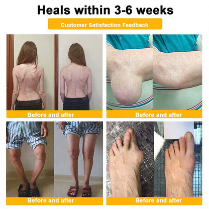 Jorondy® 🐝Bee Venom Pain-Relief Bone Healing Spray （Specially for older adults ）