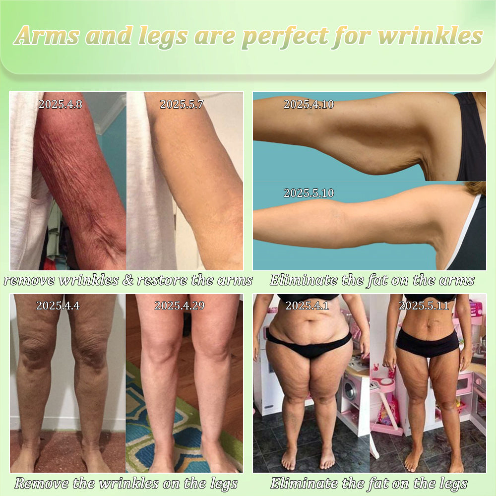 Jorondy® Firming Cream——Visibly Firms in Just 21 Days – Without Surgery or Irritation.