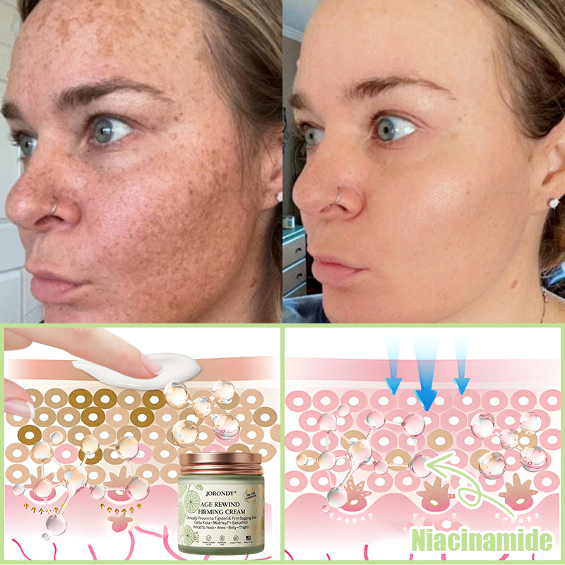 Jorondy® Firming Cream——Visibly Firms in Just 21 Days – Without Surgery or Irritation