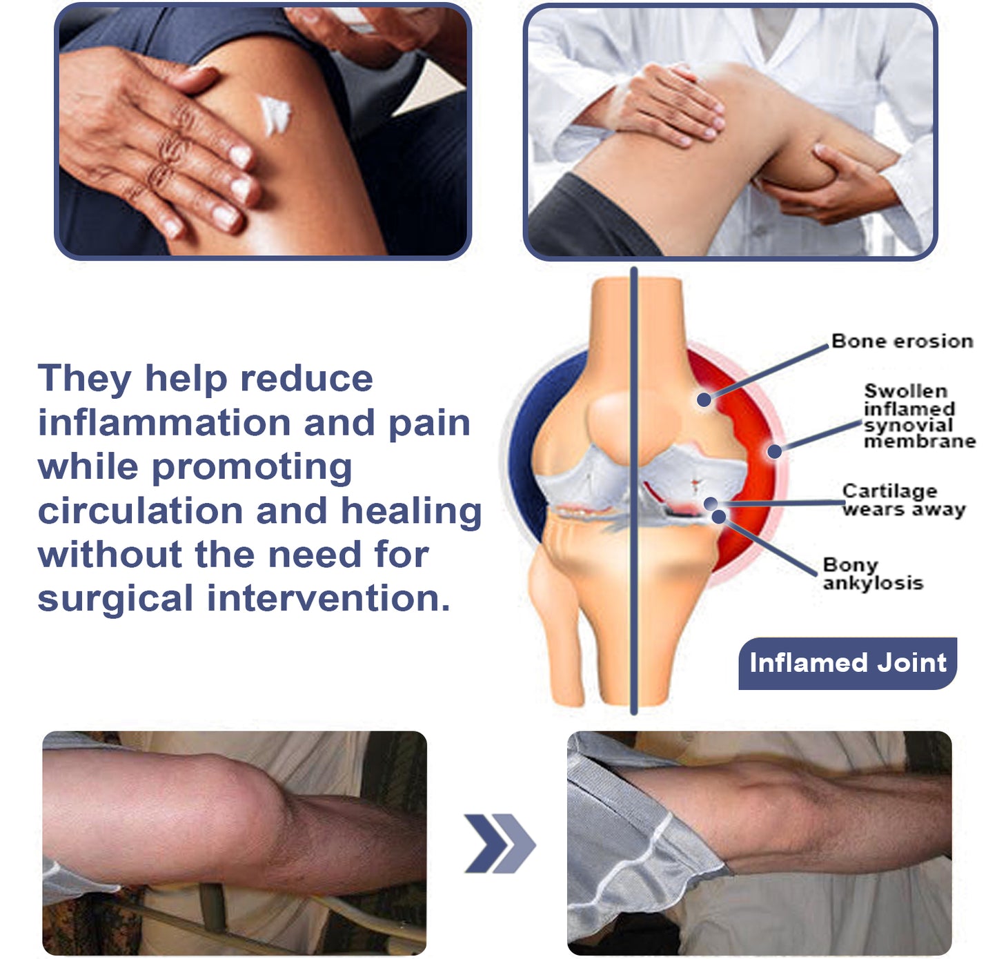 ADFIRE™ Dual Action Joint Therapy Cream
