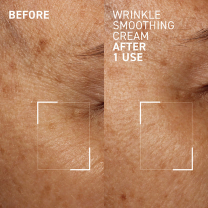 🔥Last Day Sale! 80% OFF!🔥||WRINKLE SMOOTHING CREAM