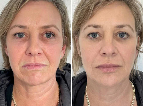 Crema Reafirmante JORONDY® Power Lift - ¡Último día de oferta! 🔥90 % de descuento