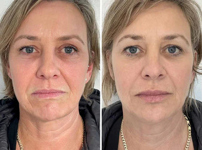 Crema Reafirmante JORONDY® Power Lift - ¡Último día de oferta! 🔥90 % de descuento