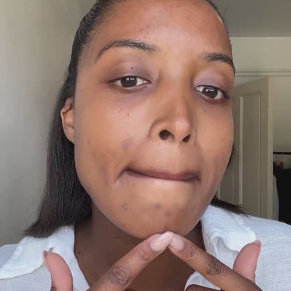 JORONDY Exfoliator Anti-Aging Skin-Renewing Exfoliating Treatment